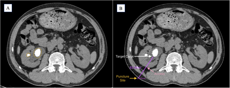 Figure 1
