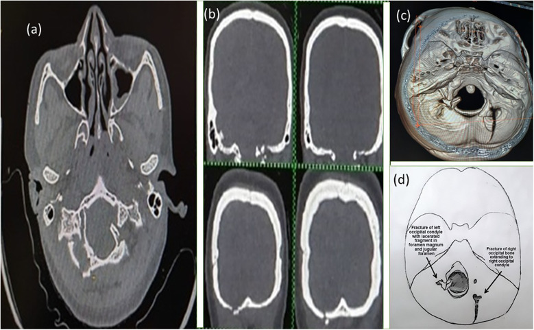 Figure 1