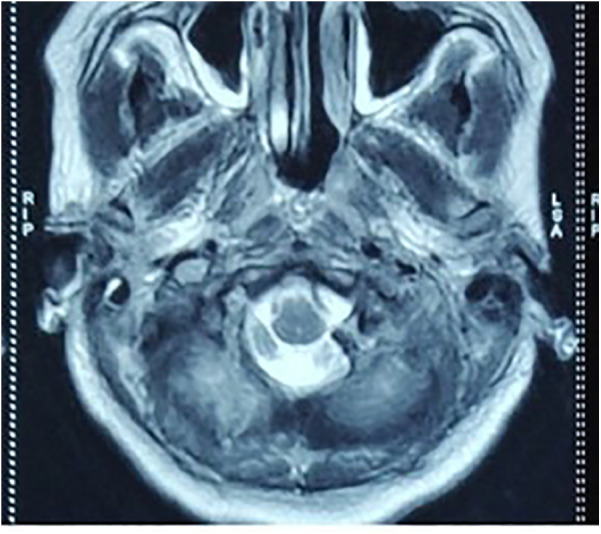 Figure 2