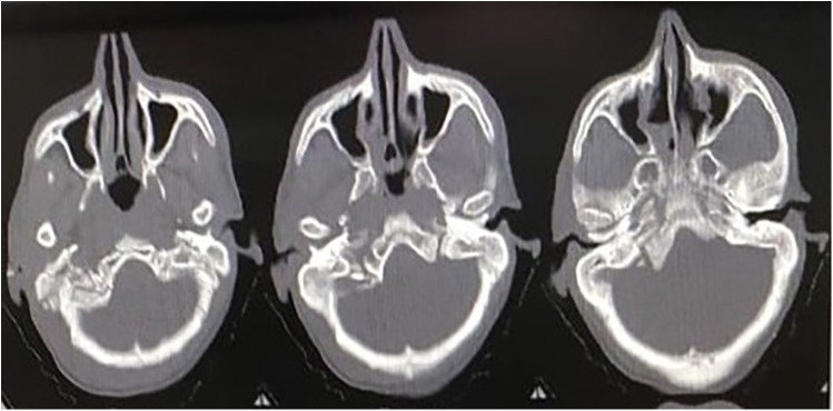 Figure 3