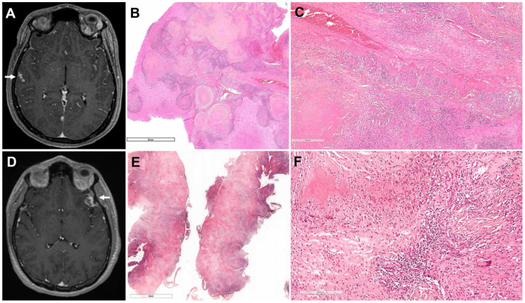 Figure 1