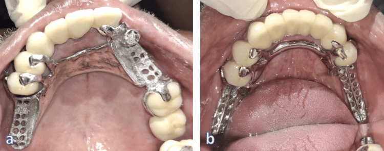 Figure 11