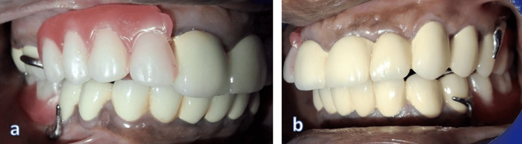 Figure 12