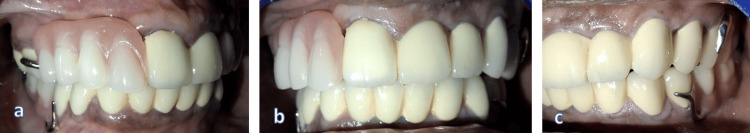 Figure 14