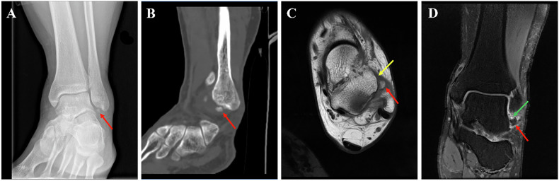Figure 6
