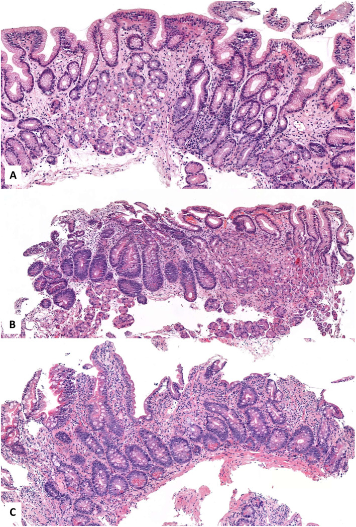 FIGURE 2