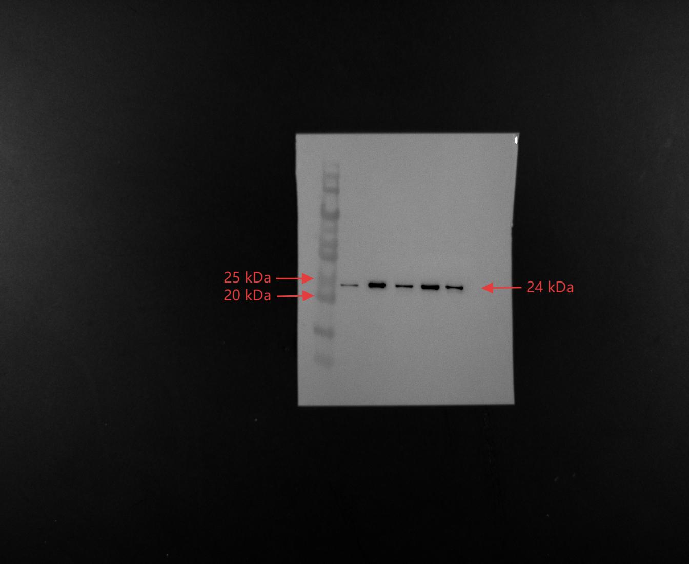 Figure 11
