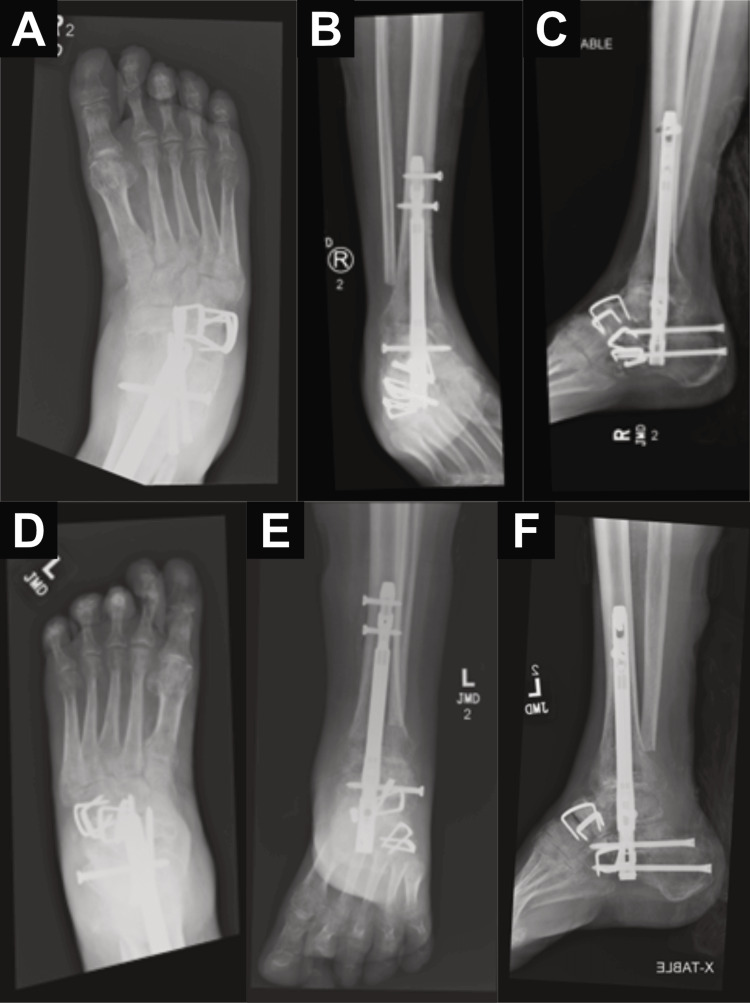 Figure 10