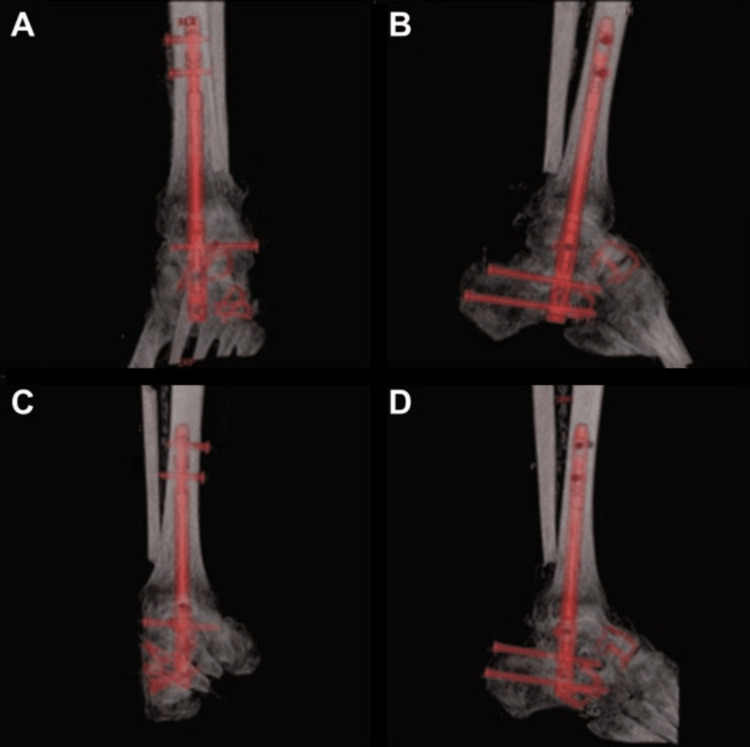 Figure 11