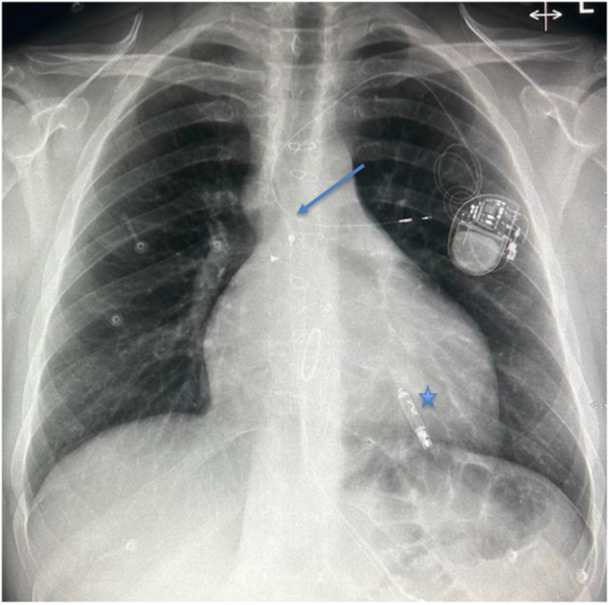 Figure 6