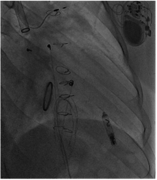 Figure 5
