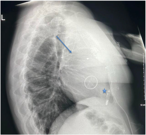 Figure 7
