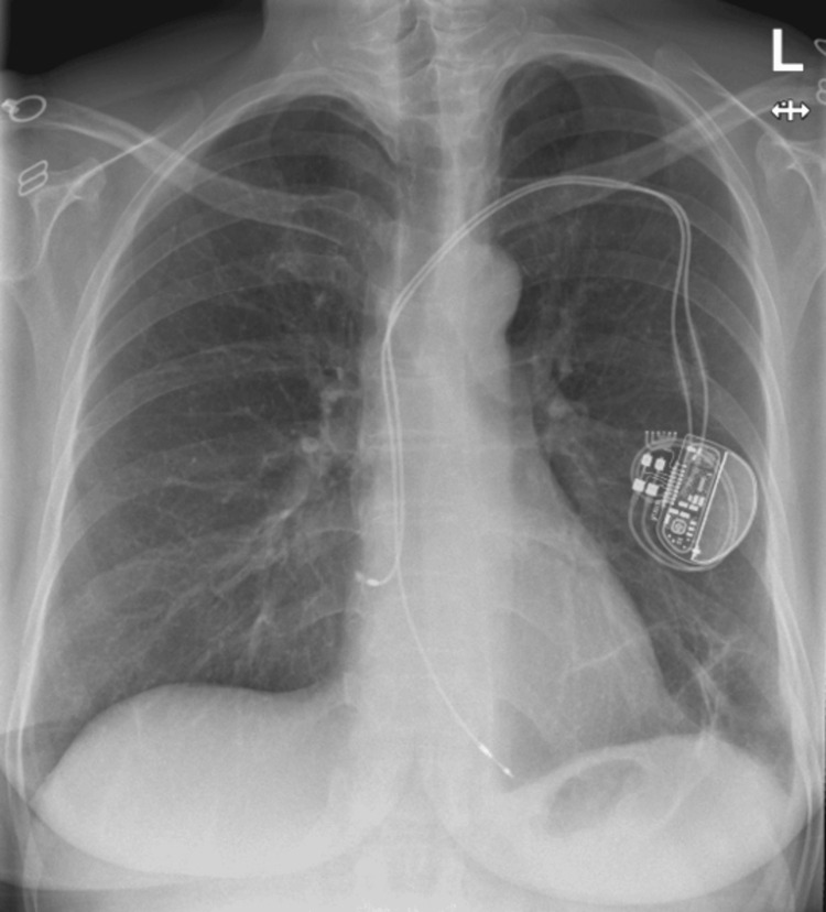 Figure 7