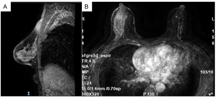 Figure 1