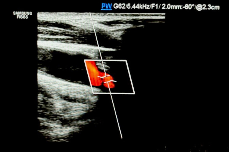Figure 2