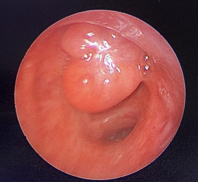 Figure 9