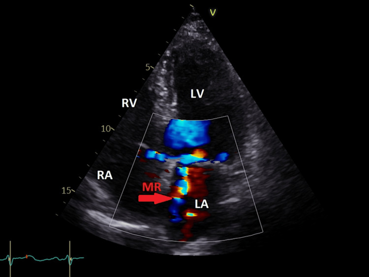 Figure 2