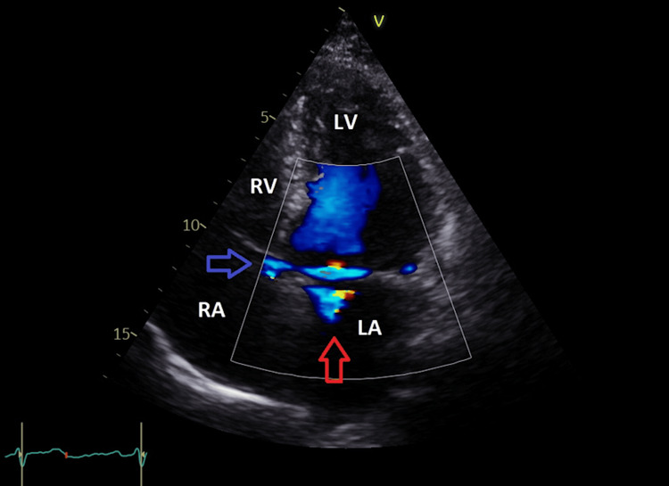 Figure 4