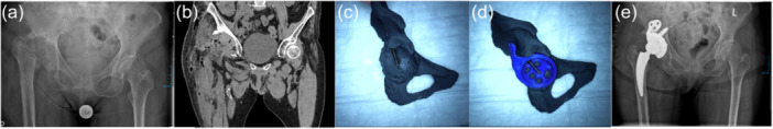 Figure 10