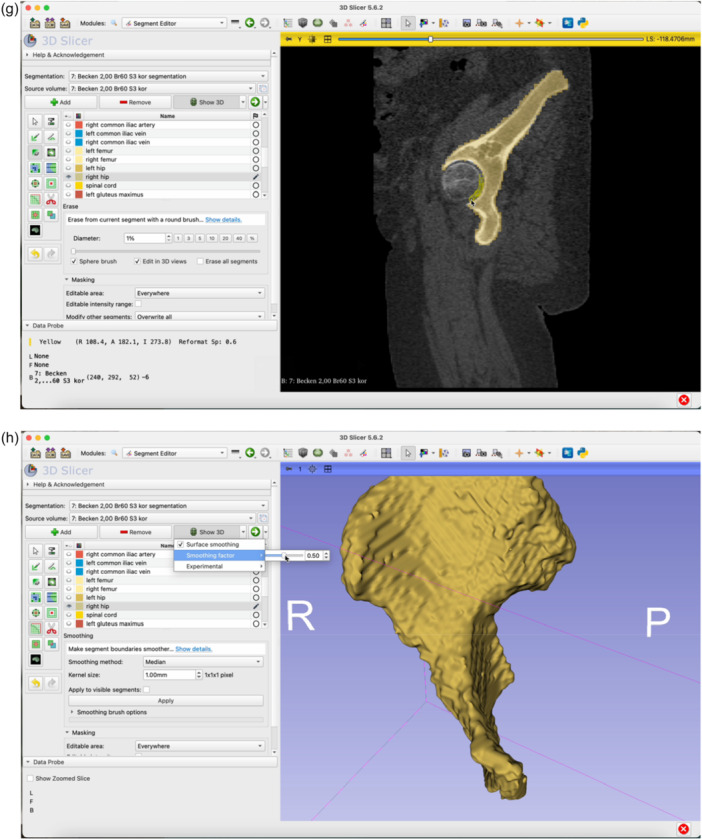 Figure 12