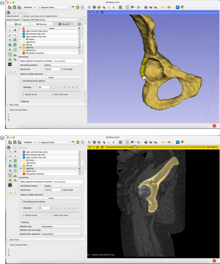 Figure 13
