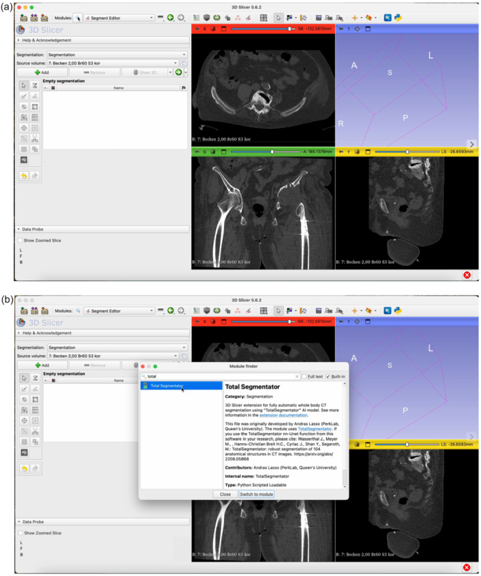 Figure 15