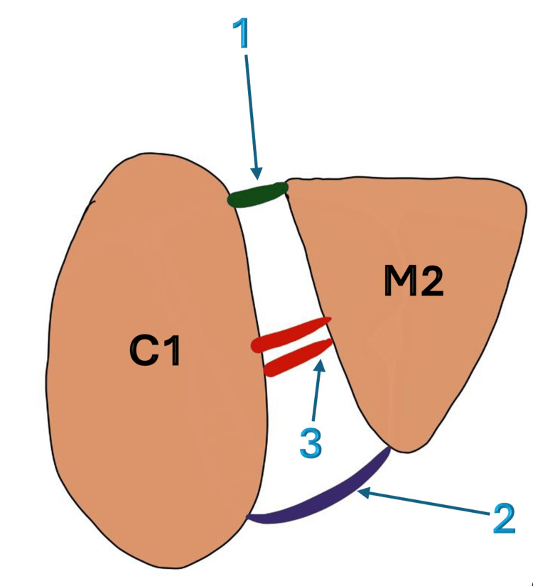 Figure 2
