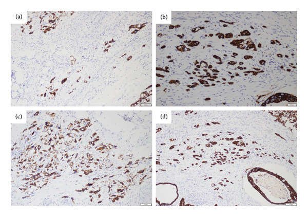 Figure 17
