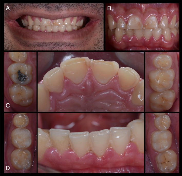 FIGURE 1