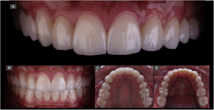 FIGURE 15