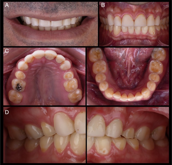 FIGURE 2