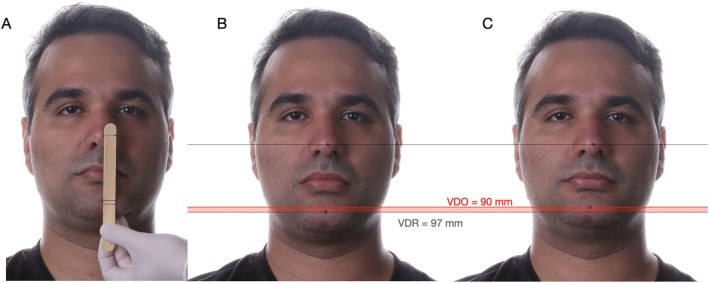 FIGURE 3