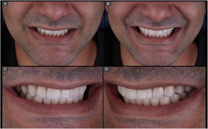 FIGURE 16