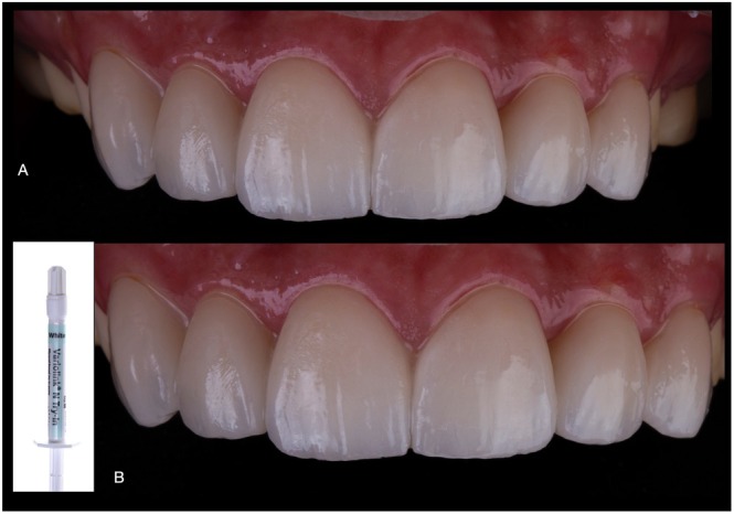 FIGURE 12