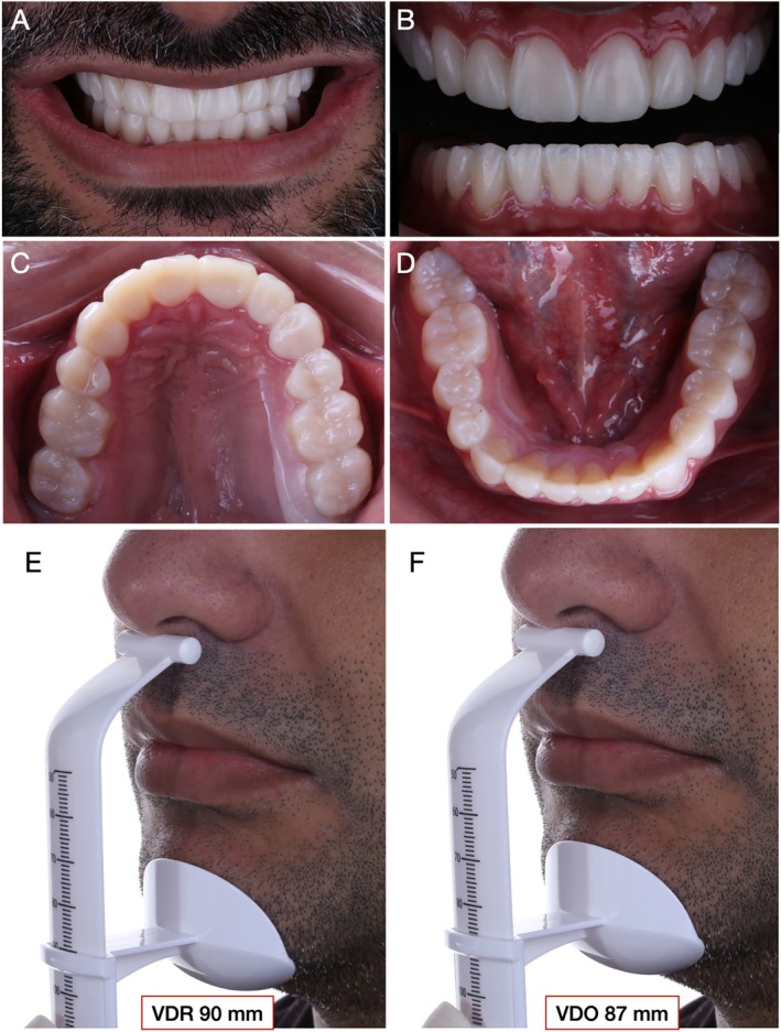 FIGURE 6