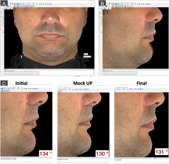 FIGURE 18