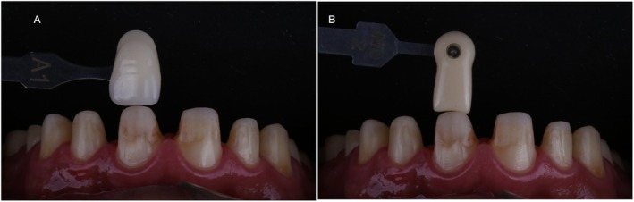 FIGURE 10