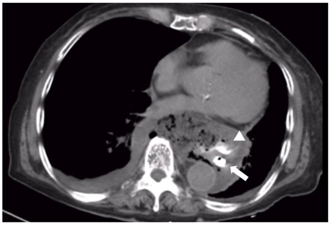 FIGURE 1