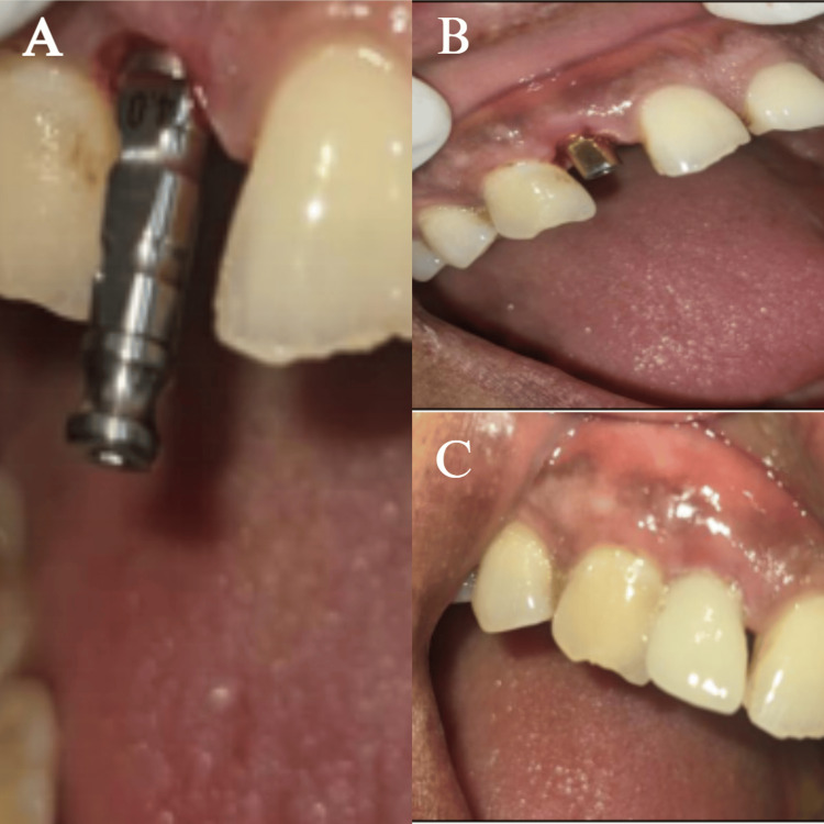 Figure 9