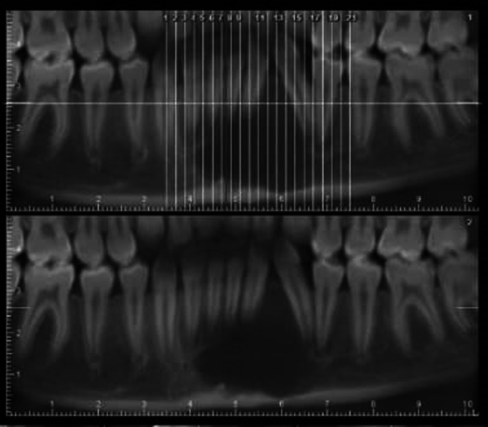 FIGURE 2