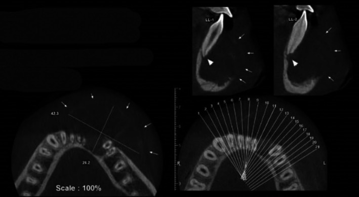 FIGURE 3