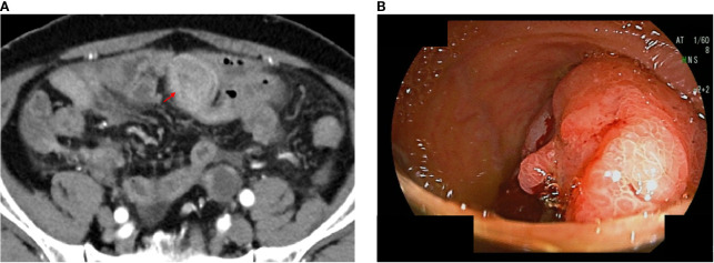 Figure 1