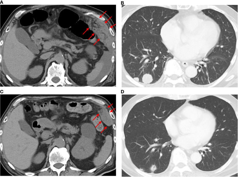 Figure 4