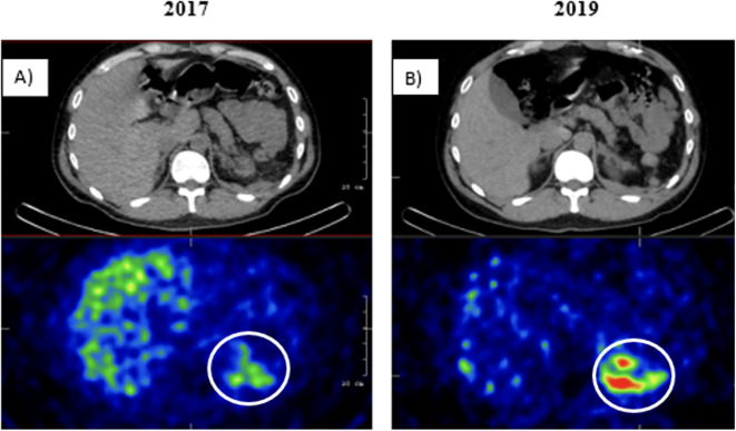Figure 2
