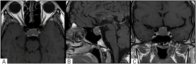 Figure 1