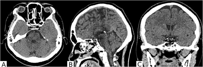 Figure 4