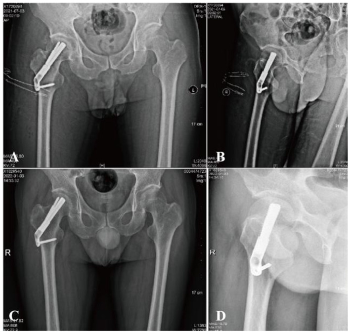Figure 2