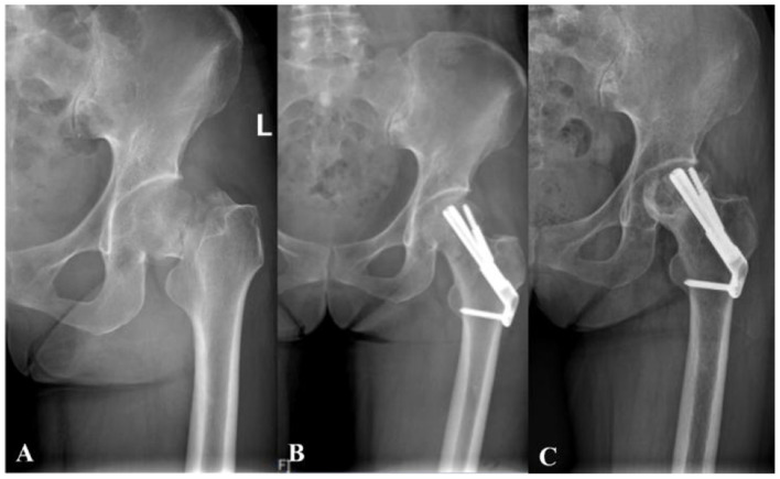 Figure 4