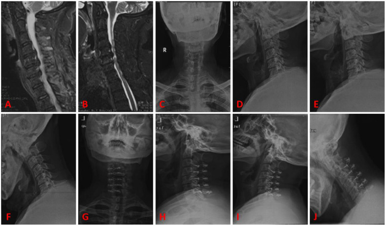 Figure 4