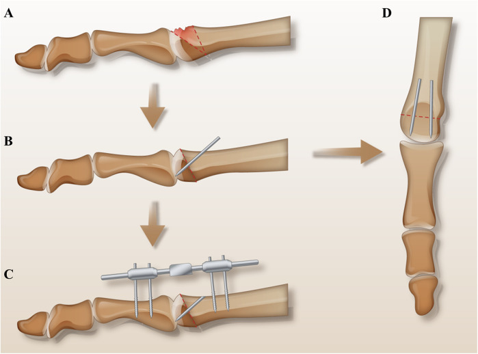 Figure 2